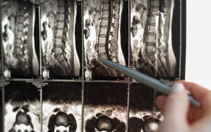 Spinal Surgeons Rancho Santa Margarita